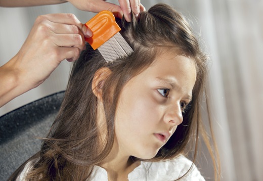 how to check yourself for lice 