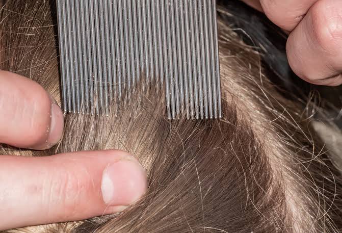 how to check yourself for lice 